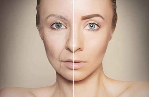 注射肉毒素除皺效果如何?如何去皺紋?