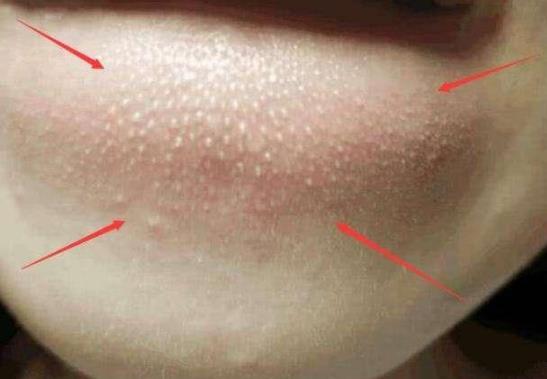 �۴������x����Ć������ȥ���۴̣�