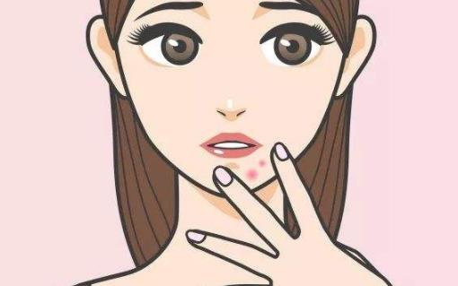 下巴長痘怎么辦?下巴長痘的原因