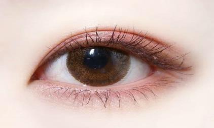 開眼角是什么?開眼角手術要注意什么