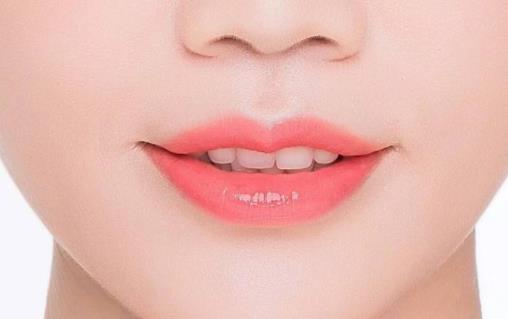 豐唇后多久能消腫?豐唇術(shù)注意事項