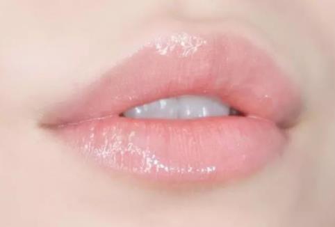 豐唇后多久能消腫?豐唇術(shù)注意事項