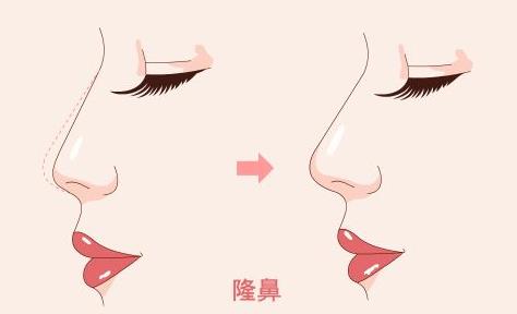 ע�䲣����¡����Σ�U�᣿¡�����g����Щ�L�U