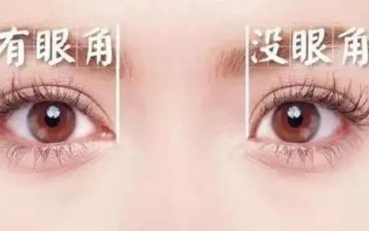 開眼角效果好嗎?開眼角會留疤嗎?