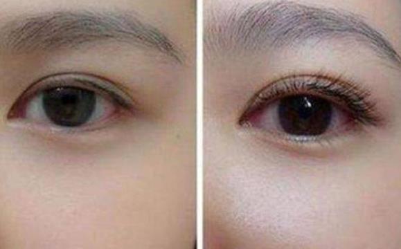 �Nֲ���ý�ë�S�ֶ�ã��Nֲ��ë�����X��