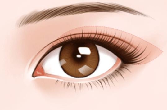 種植永久睫毛維持多久?種植睫毛多少錢?