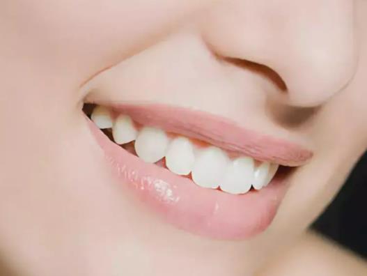 牙結石3度嚴重嗎?牙結石為什么會自動脫落