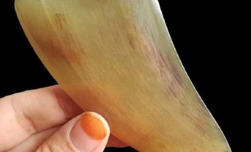 砭石和紫砂艾灸罐哪個更好 砭石和牛角刮痧哪個好