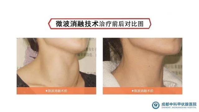 南京建國甲狀腺醫院檢查價格致力提高全民健康水平