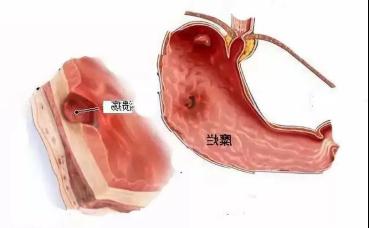 �F�΢��(chu��ng)θ�c�����t(y��)Ժ������ҕ��θ���}���������ԝ���