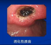 �F�΢��(chu��ng)θ�c�����t(y��)Ժ������ҕ��θ���}���������ԝ���