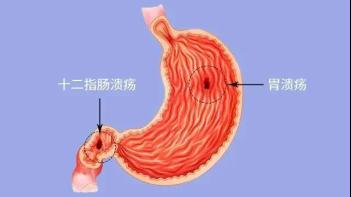 �F�΢��(chu��ng)θ�c�����t(y��)Ժ������ҕ��θ���}���������ԝ���