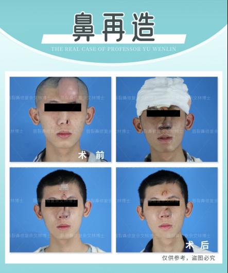 ȫ�������ԭ��������ʲô�^(q��)�e�������ֲ�ʿ���