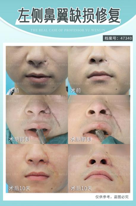 ȫ�������ԭ��������ʲô�^(q��)�e�������ֲ�ʿ���