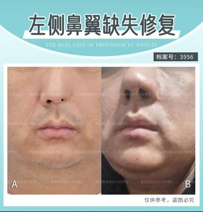 ȫ�������ԭ��������ʲô�^(q��)�e�������ֲ�ʿ�����