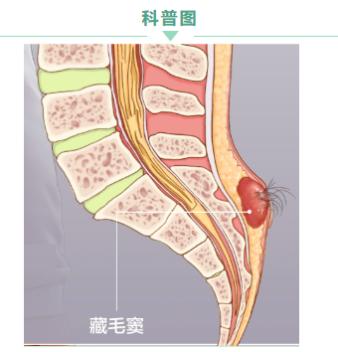 �ؑc�|����c�t(y��)Ժ���c�����삥�v�⣺�L��ƨ�������桰�]����-��ǧ�f�e����