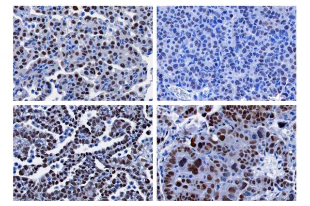 �ΰ��о� | ���ݴ�W(xu��)��ɼ����У���ֵ��о��ɹ����Ƿ������M(j��n)���ڷΰ����ί���ʽ��