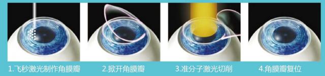 ���ݰ��w���ҕ���g(sh��)�����X�����˽���ժ�R��