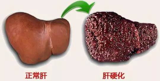 �β��ƺ鳼�t�������㣺���������@���c����Ӳ���õĿ�