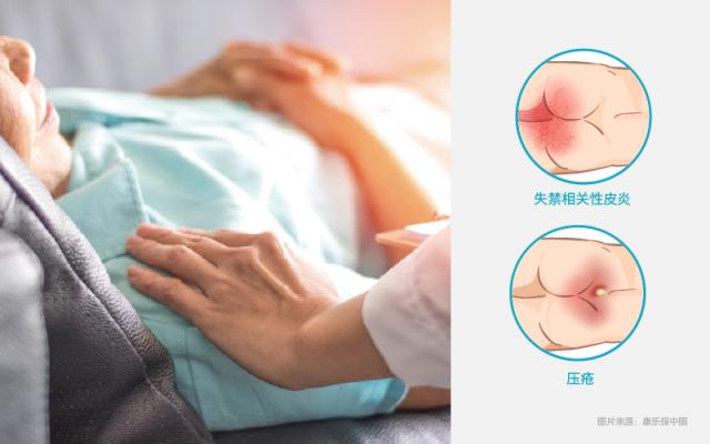 �����˽�ʧ�����P��Ƥ�׼��Y����Ƥ�w�o������