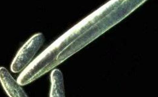 世界上最大的細菌 納米比亞珍珠硫細菌闊度有0.1-0.3毫米