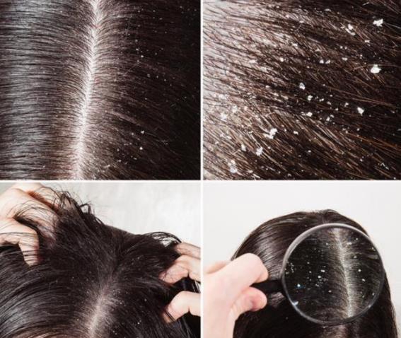 ��ôȥ���^Ƥм����ʲô�����^Ƥм��