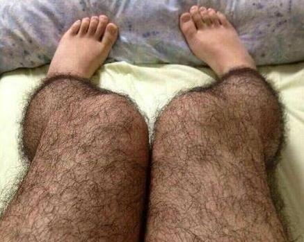 女人毛發(fā)太旺盛是什么原因該怎么脫毛 體毛越剃越濃嗎