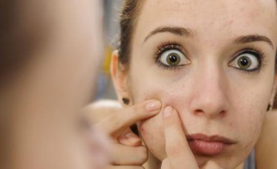 為什么月經期會長痘?怎么預防經期長痘?