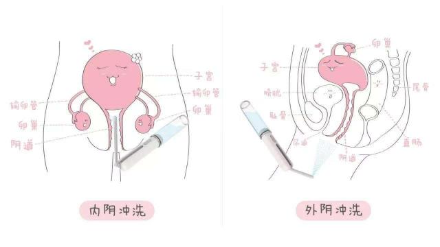 Ů��ꎵ���ʲô���ӵĈDƬ���� ꎲ��挍������ʽY���D