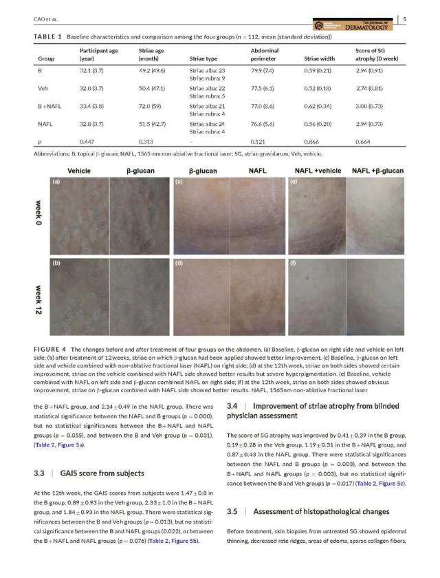 精準醫療概念下,妊娠紋患者迎來新選擇 精準醫療概念下,妊娠紋患者迎來新選擇