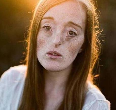 世界上最丑的5個女模特排名,梅勒妮·蓋多斯最令人驚訝