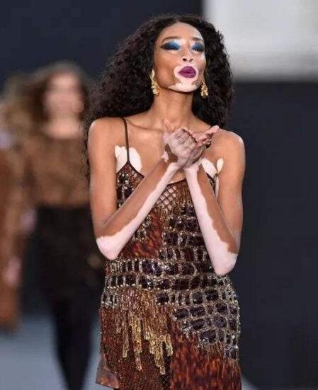 世界上最丑的5個女模特排名,梅勒妮·蓋多斯最令人驚訝