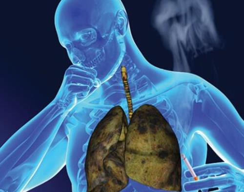 世界十大疑難雜癥排名,腸癌、心臟病困擾著患者