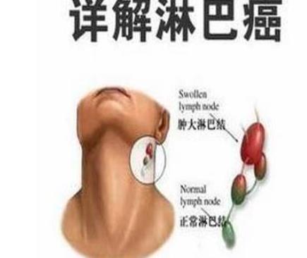 世界上十大必死病排名,狂犬病、晚期癌癥死亡率非常高