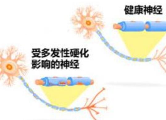十大女性易得的病排行榜,乳腺癌發(fā)不了高、宮頸癌是惡性腫瘤