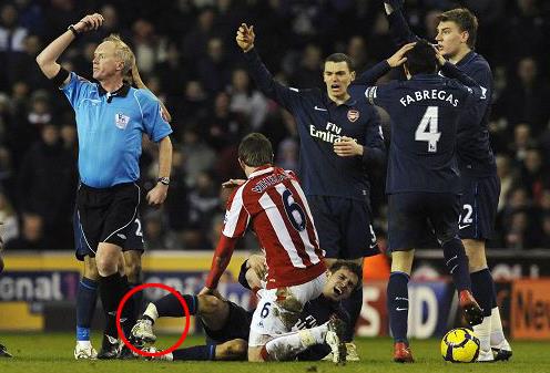 足壇十大最恐怖傷情排行榜 足壇最嚴重傷情盤點