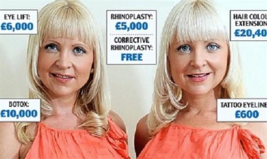 世界十大最瘋狂的整形手術排名 男子布賴恩隆出38C胸