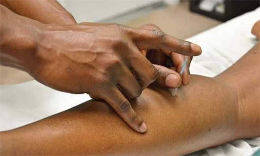 古代十大止痛方法排名 排名第一的居然是罌粟