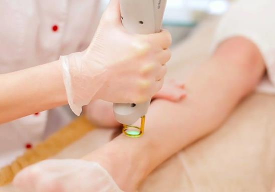 激光脫毛會引起狐臭嗎?激光脫毛可以脫臉上的汗毛嗎 激光脫毛會引起狐臭嗎?激光脫毛可以脫臉上的汗毛嗎