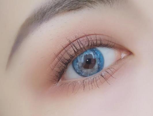 雙眼皮太寬太深可以修復嗎?雙眼皮疤痕凹陷能好嗎 雙眼皮太寬太深可以修復嗎?雙眼皮疤痕凹陷能好嗎