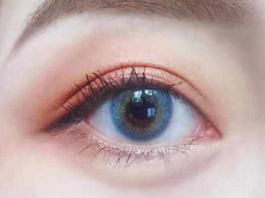 割完雙眼皮多久能化妝?雙眼皮疤痕疙瘩會消嗎 割完雙眼皮多久能化妝?雙眼皮疤痕疙瘩會消嗎