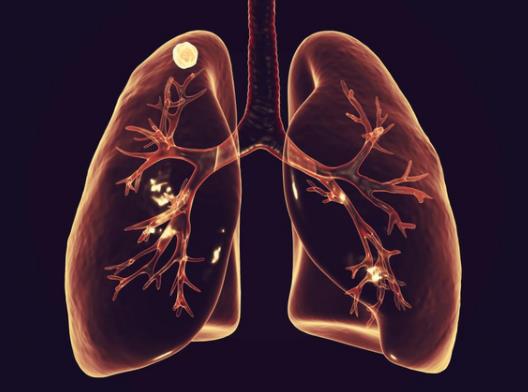 84�q���˷�ȫ���оȆ᣿ƽ�r���ӱ��o�Լ��ķ�