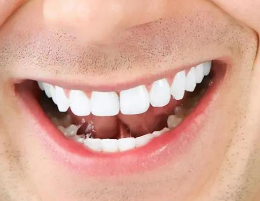 �Nֲ�������ô�Æ᣿�Nֲ����ʹ�É���