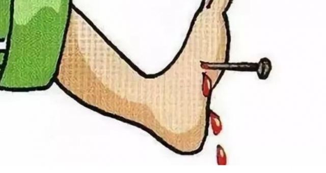 摔傷破皮用打破傷風(fēng)針嗎 傷到什么程度需要打破傷風(fēng) 摔傷破皮用打破傷風(fēng)針嗎 傷到什么程度需要打破傷風(fēng)