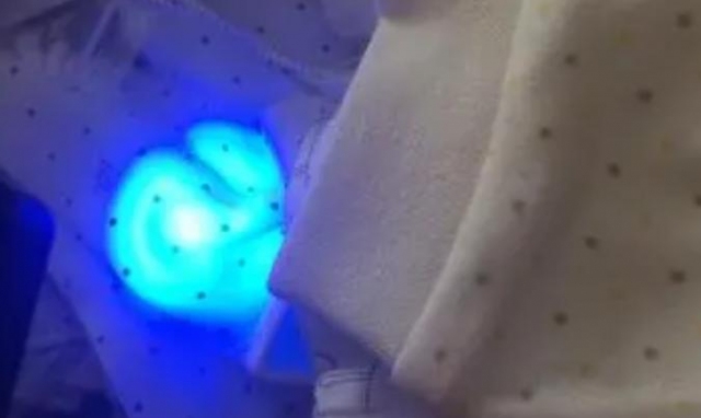 香皂有熒光劑有害嗎 熒光劑毒性大嗎 香皂有熒光劑有害嗎 熒光劑毒性大嗎