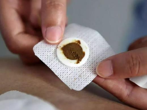 哪些人不能貼三伏貼?三伏貼提前兩天至三天貼可以嗎 哪些人不能貼三伏貼?三伏貼提前兩天至三天貼可以嗎