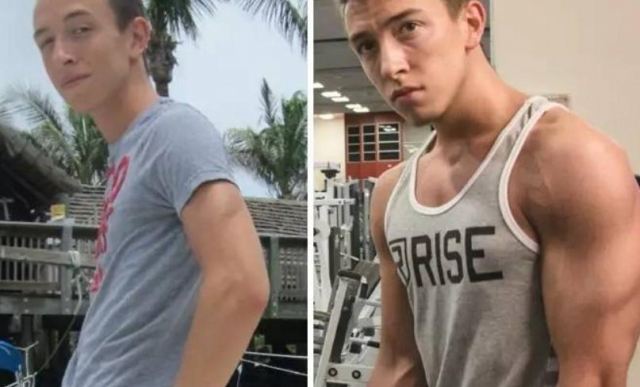 瘦的人增肌是做無氧運動嗎?太瘦了該怎么增肌 瘦的人增肌是做無氧運動嗎?太瘦了該怎么增肌