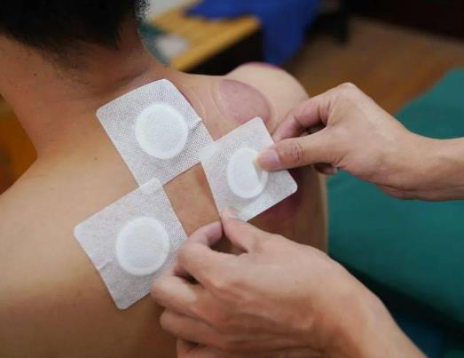 �����N�Ա�������ô�a(b��)�ȣ������N����ѩ����Ӱ푆�