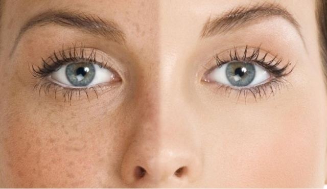 維生素c片可以每天吃嗎 維生素c片是含著吃嗎 維生素c片可以每天吃嗎 維生素c片是含著吃嗎