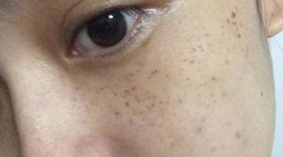 維生素C晚上吃還是早上吃好 維生素C什么時候吃最好 維生素C晚上吃還是早上吃好 維生素C什么時候吃最好